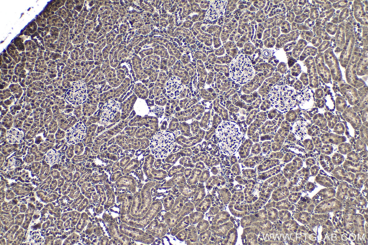 Immunohistochemical analysis of paraffin-embedded rat kidney tissue slide using KHC1667 (EWSR1/EWS IHC Kit).