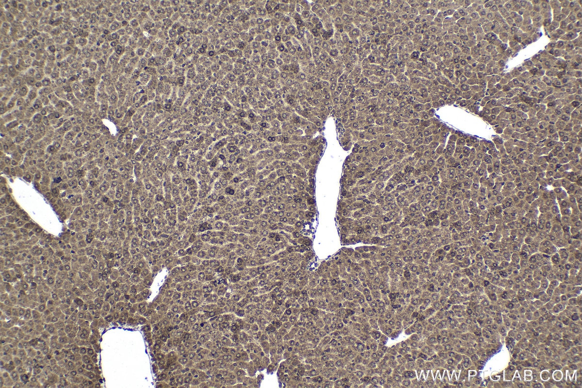 Immunohistochemical analysis of paraffin-embedded mouse liver tissue slide using KHC1667 (EWSR1/EWS IHC Kit).