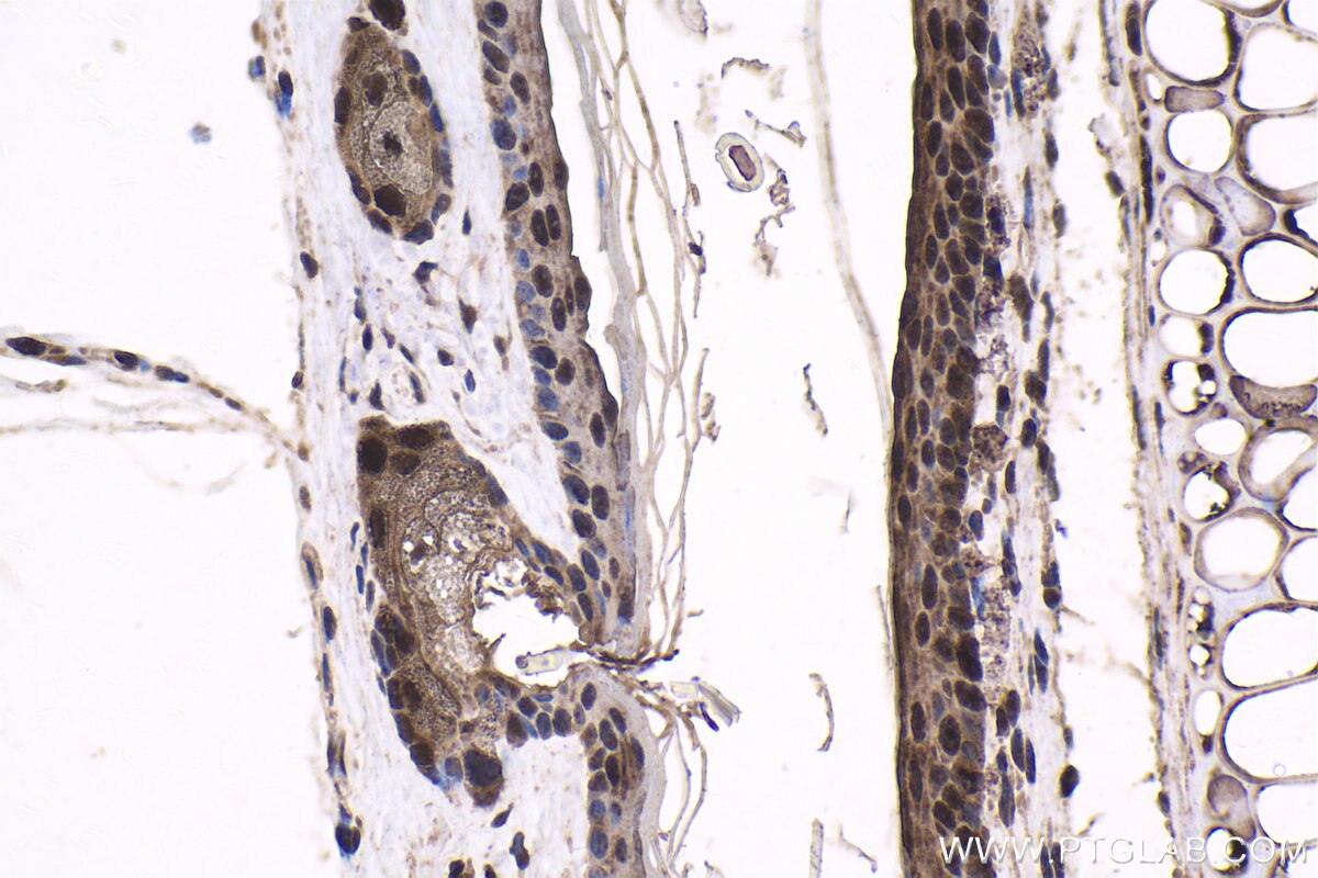 Immunohistochemical analysis of paraffin-embedded mouse skin tissue slide using KHC1665 (EXOSC10 IHC Kit).