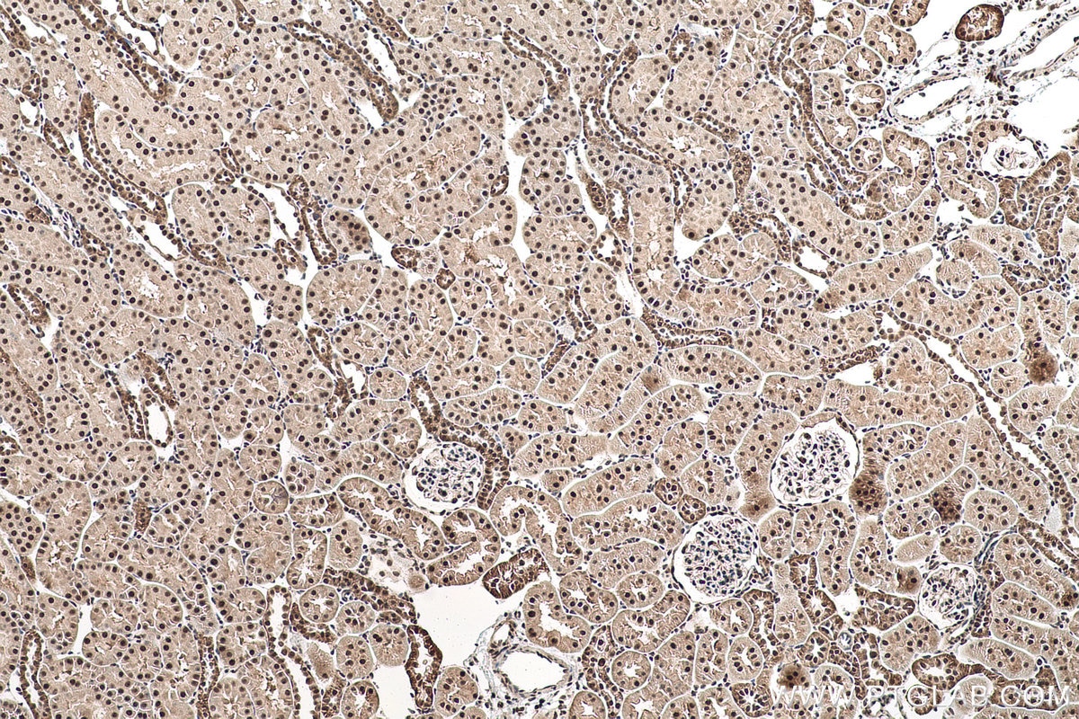 Immunohistochemical analysis of paraffin-embedded rat kidney tissue slide using KHC0955 (EXOSC7 IHC Kit).