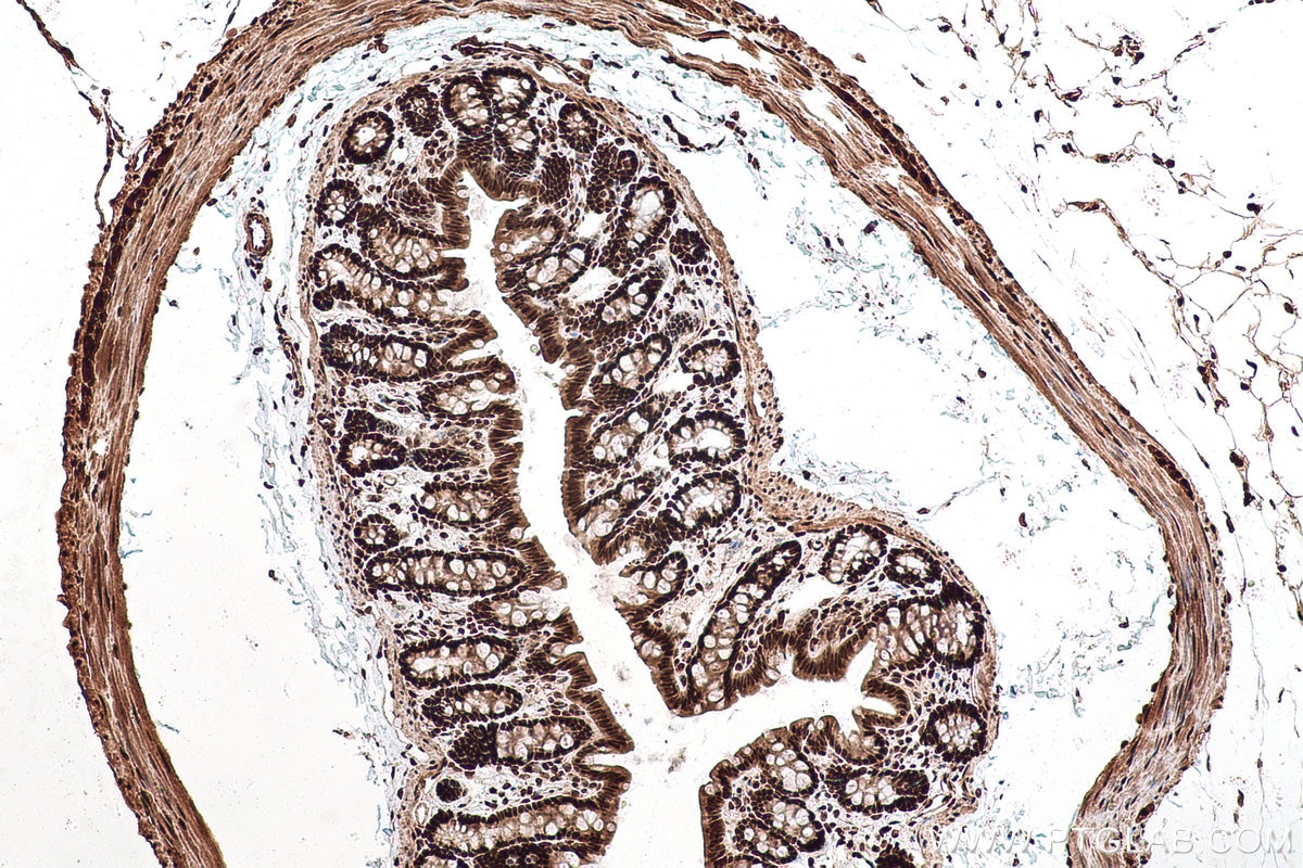 Immunohistochemical analysis of paraffin-embedded rat colon tissue slide using KHC0955 (EXOSC7 IHC Kit).