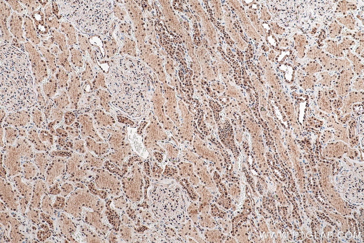 Immunohistochemical analysis of paraffin-embedded human kidney tissue slide using KHC0955 (EXOSC7 IHC Kit).