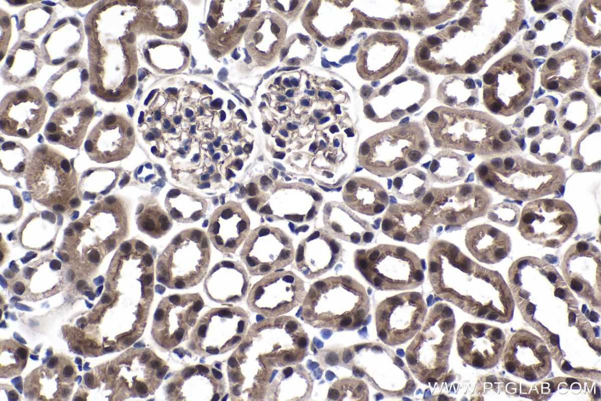Immunohistochemical analysis of paraffin-embedded mouse kidney tissue slide using KHC1678 (EXOSC9 IHC Kit).