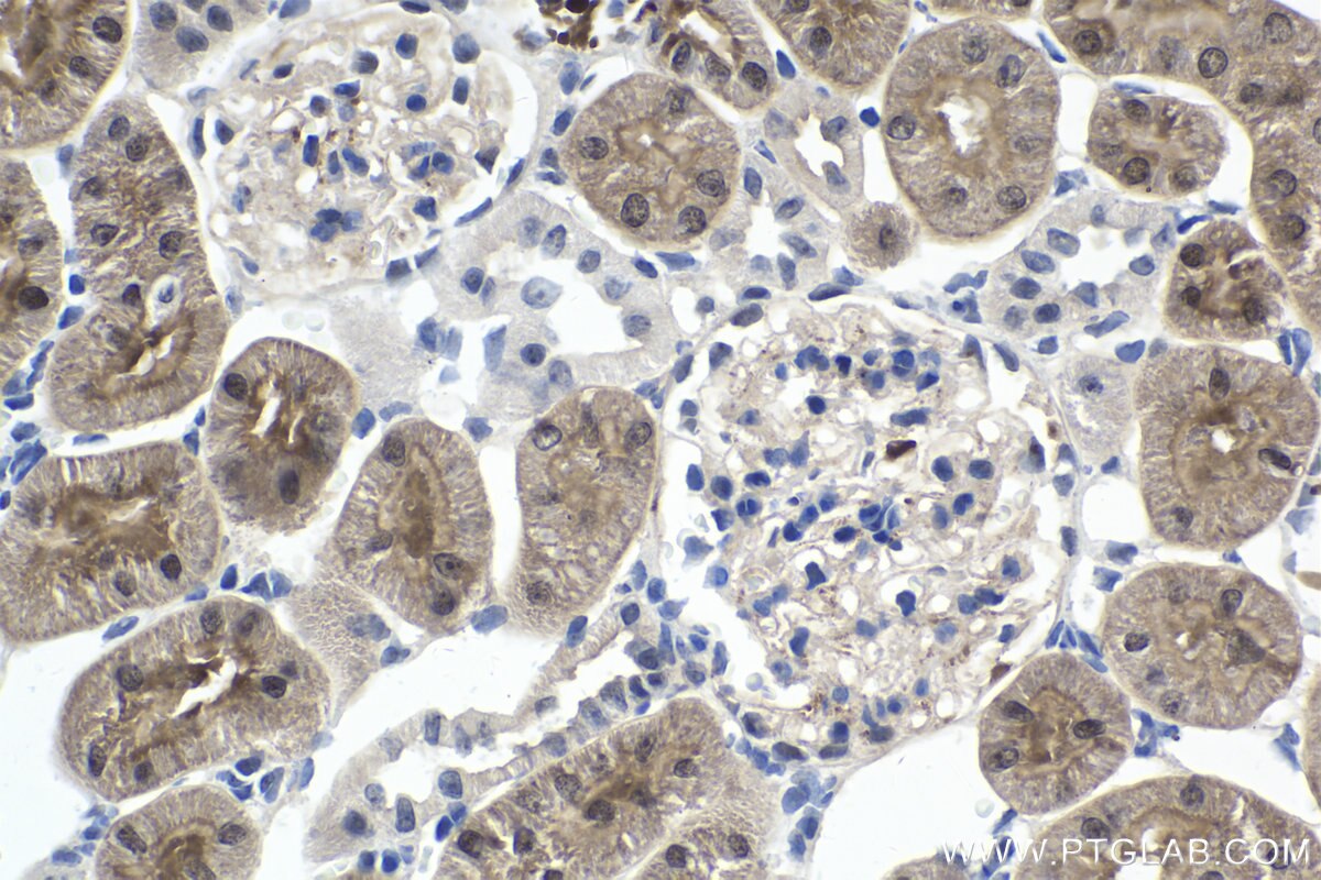 Immunohistochemical analysis of paraffin-embedded rat kidney tissue slide using KHC1678 (EXOSC9 IHC Kit).