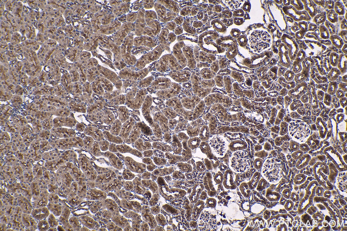 Immunohistochemical analysis of paraffin-embedded rat kidney tissue slide using KHC1417 (EYA2 IHC Kit).