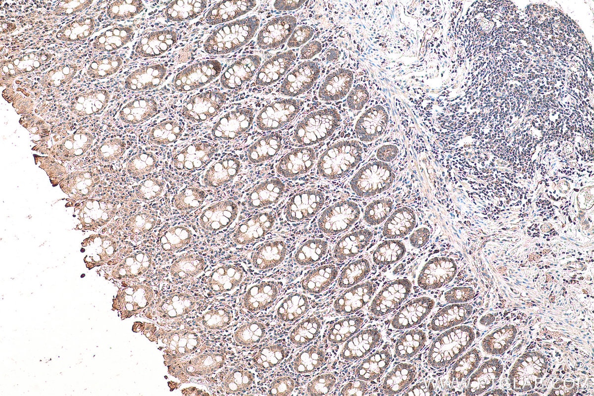 Immunohistochemical analysis of paraffin-embedded human colon tissue slide using KHC0767 (EYA4 IHC Kit).
