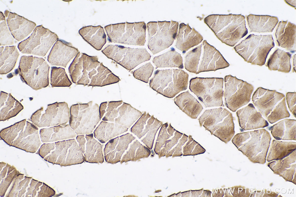 Immunohistochemical analysis of paraffin-embedded mouse skeletal muscle tissue slide using KHC0767 (EYA4 IHC Kit).