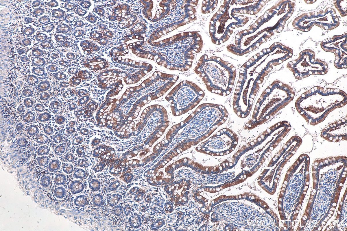 Immunohistochemical analysis of paraffin-embedded human small intestine tissue slide using KHC0094 (Ezrin IHC Kit).