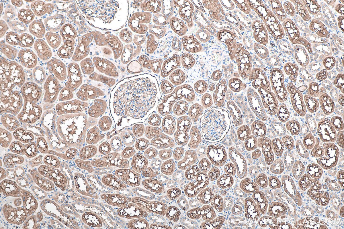 Immunohistochemical analysis of paraffin-embedded human kidney tissue slide using KHC0094 (Ezrin IHC Kit).