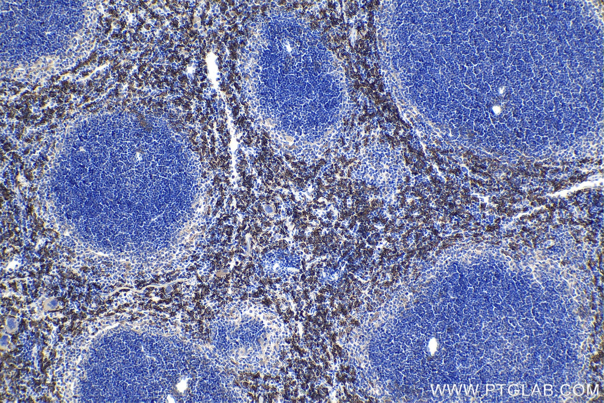 Immunohistochemical analysis of paraffin-embedded mouse spleen tissue slide using KHC0938 (F4/80 IHC Kit).