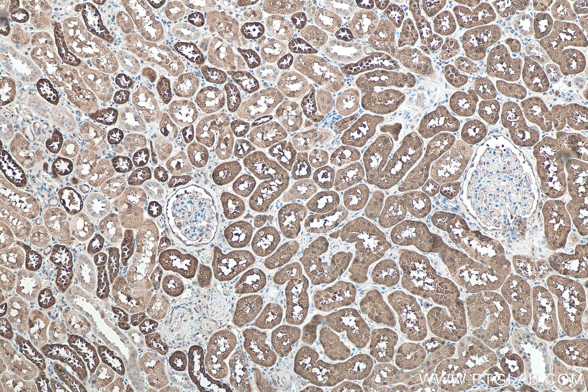 Immunohistochemical analysis of paraffin-embedded human kidney tissue slide using KHC0099 (FABP3 IHC Kit).