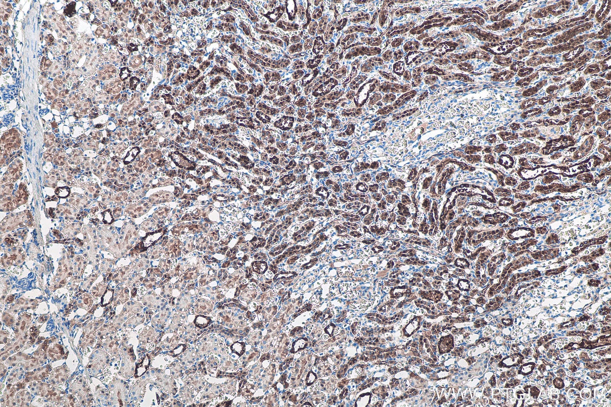 Immunohistochemical analysis of paraffin-embedded rat kidney tissue slide using KHC0099 (FABP3 IHC Kit).