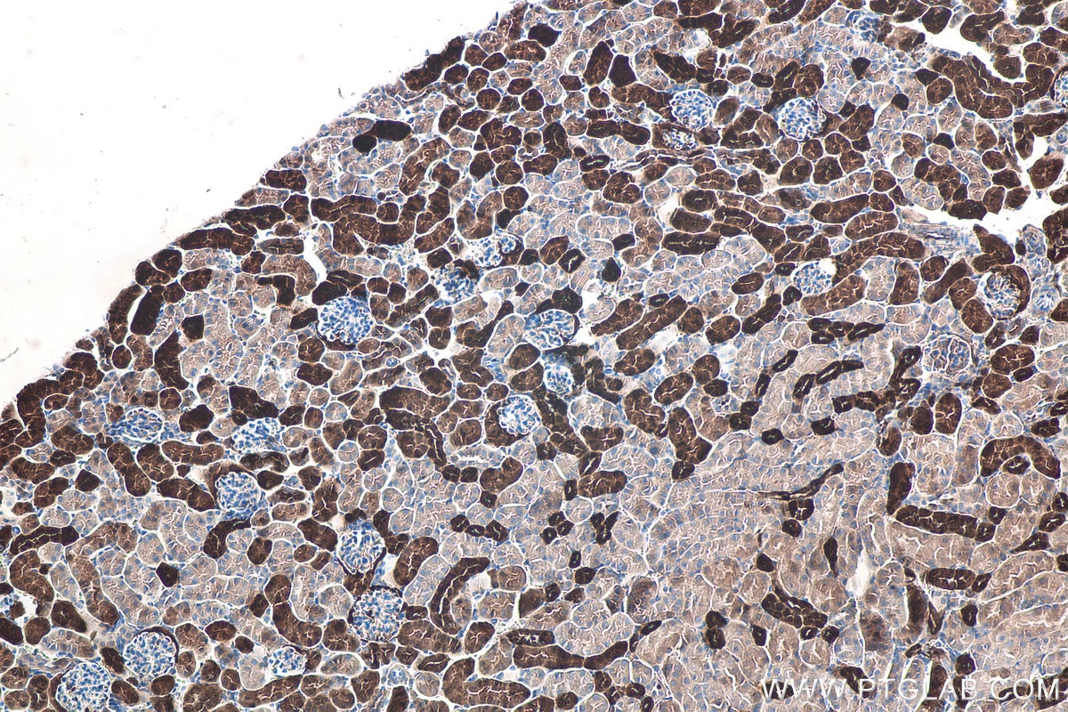 Immunohistochemical analysis of paraffin-embedded mouse kidney tissue slide using KHC0099 (FABP3 IHC Kit).