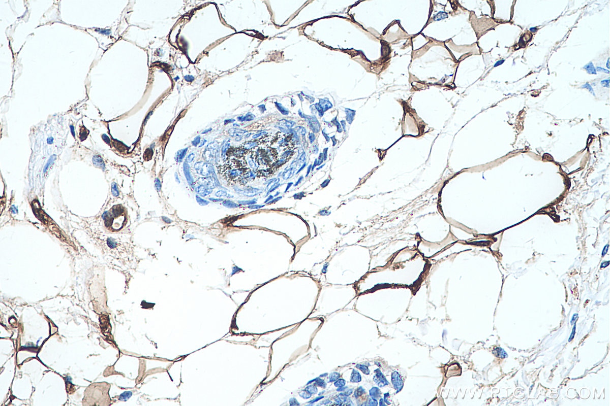 Immunohistochemical analysis of paraffin-embedded mouse skin tissue slide using KHC0237 (FABP4 IHC Kit).