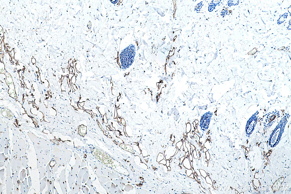 Immunohistochemical analysis of paraffin-embedded rat skin tissue slide using KHC0237 (FABP4 IHC Kit).