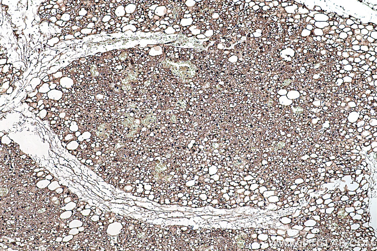 Immunohistochemical analysis of paraffin-embedded rat brown adipose tissue slide using KHC0237 (FABP4/AP2 IHC Kit).