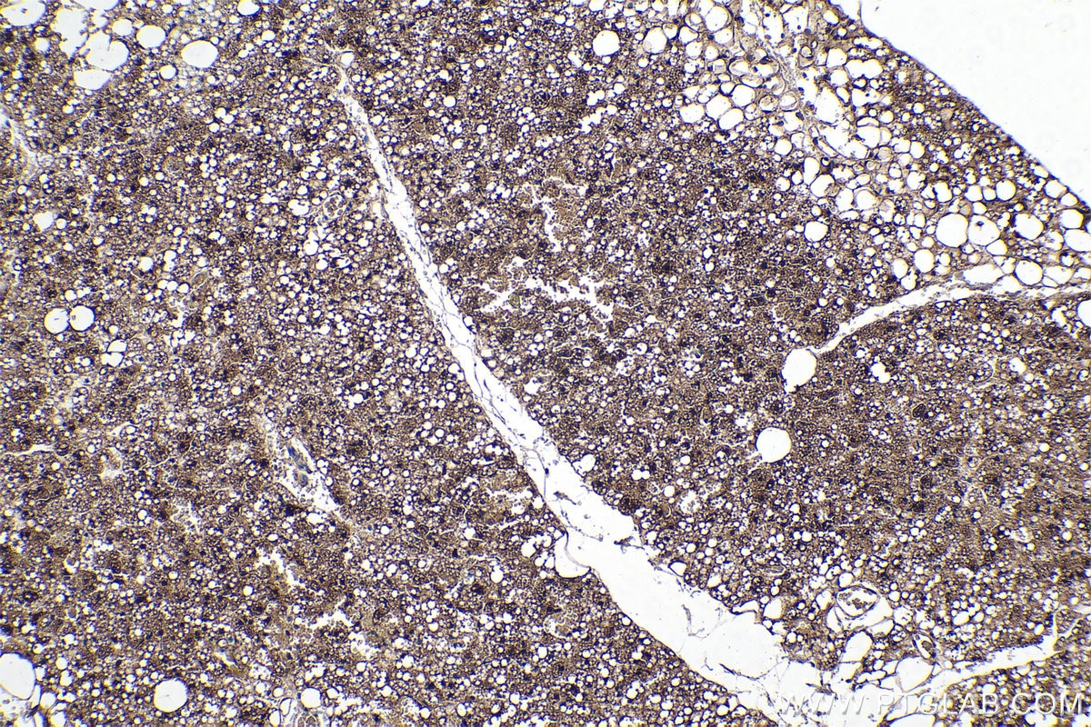 Immunohistochemical analysis of paraffin-embedded rat brown adipose tissue slide using KHC0238 (FABP5 IHC Kit).
