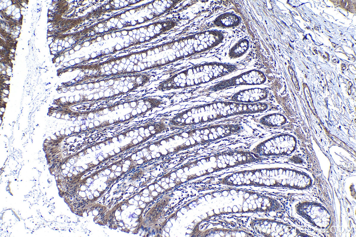 Immunohistochemical analysis of paraffin-embedded human colon tissue slide using KHC1251 (FADD IHC Kit).