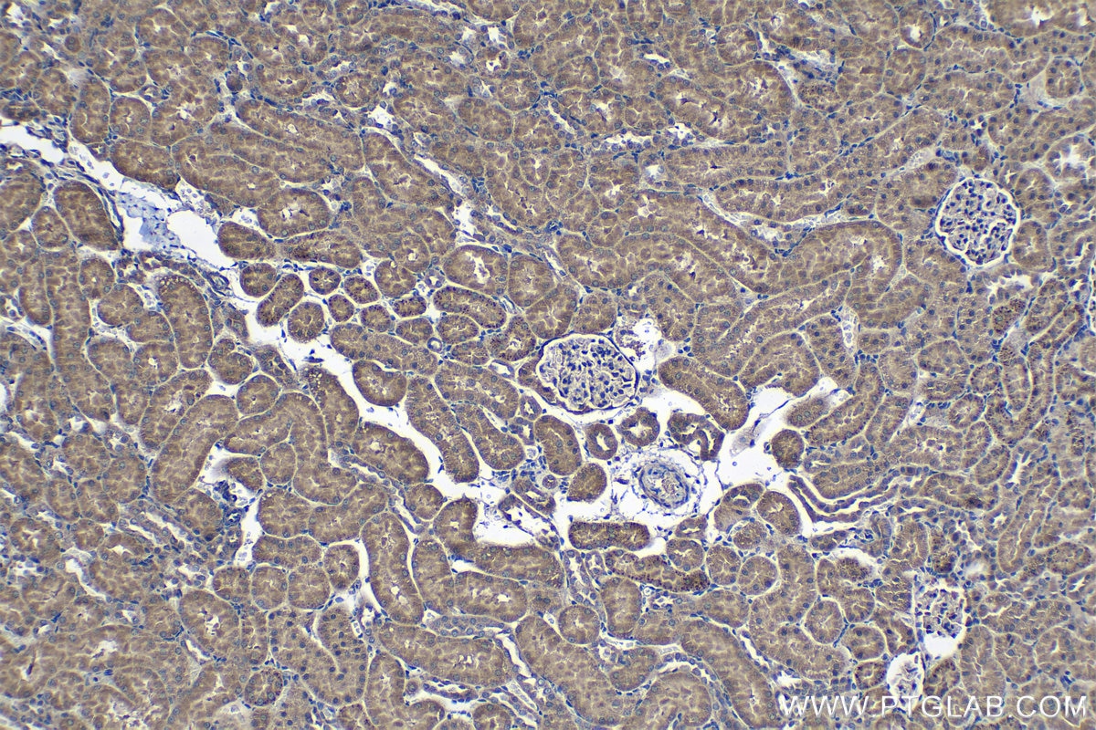 Immunohistochemical analysis of paraffin-embedded rat kidney tissue slide using KHC1251 (FADD IHC Kit).