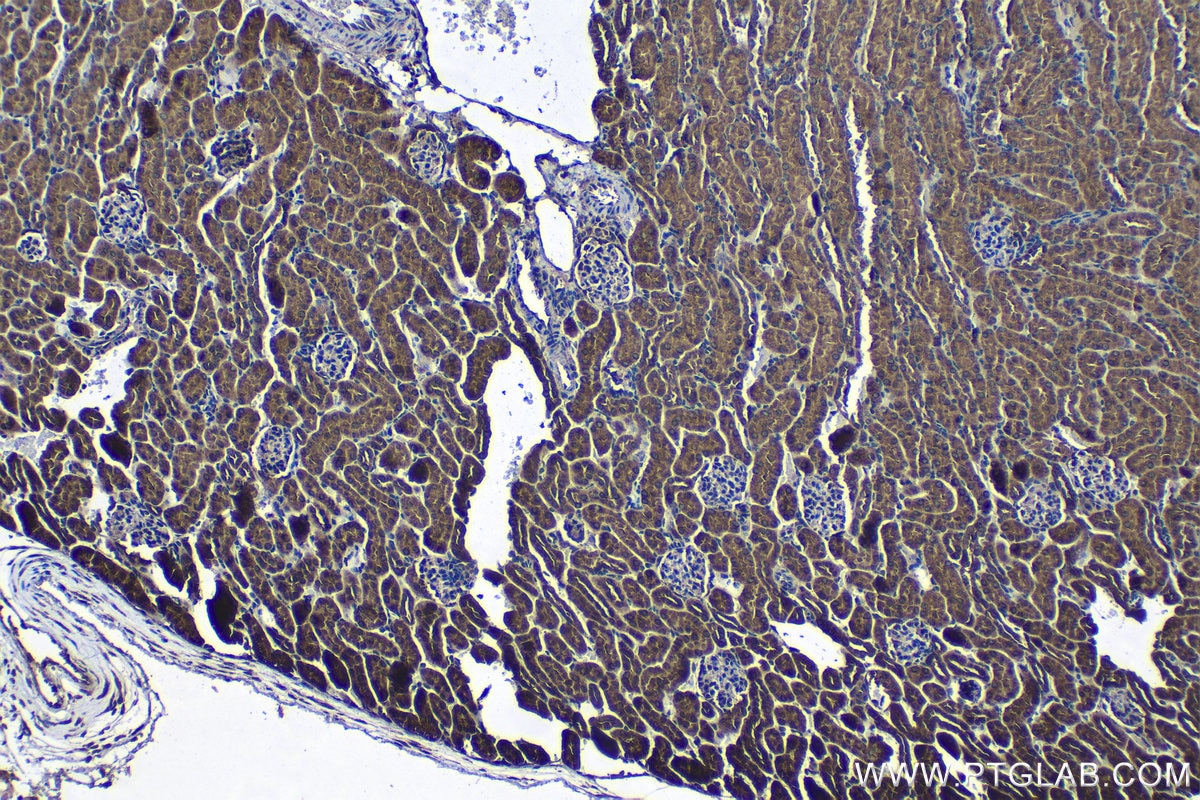 Immunohistochemical analysis of paraffin-embedded mouse kidney tissue slide using KHC1251 (FADD IHC Kit).