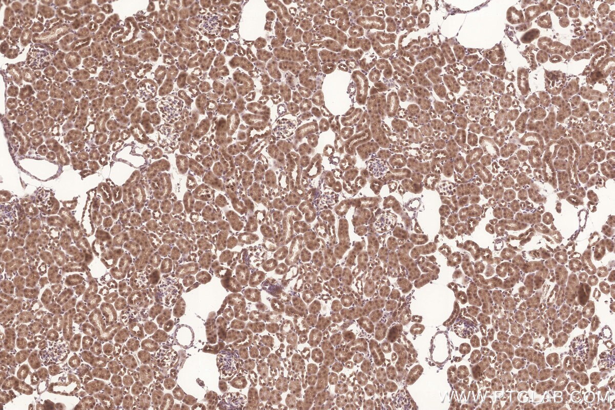 Immunohistochemical analysis of paraffin-embedded mouse kidney tissue slide using KHC3266 (FAM46C IHC Kit).