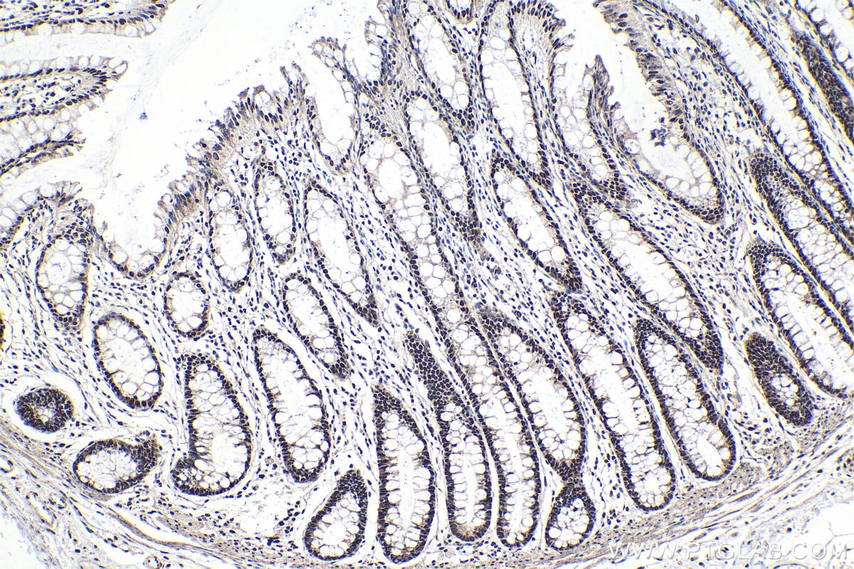 Immunohistochemical analysis of paraffin-embedded human colon tissue slide using KHC1378 (FAM50A IHC Kit).