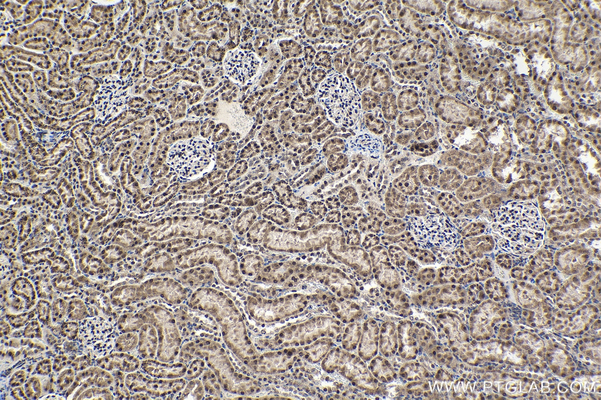 Immunohistochemical analysis of paraffin-embedded rat kidney tissue slide using KHC1378 (FAM50A IHC Kit).