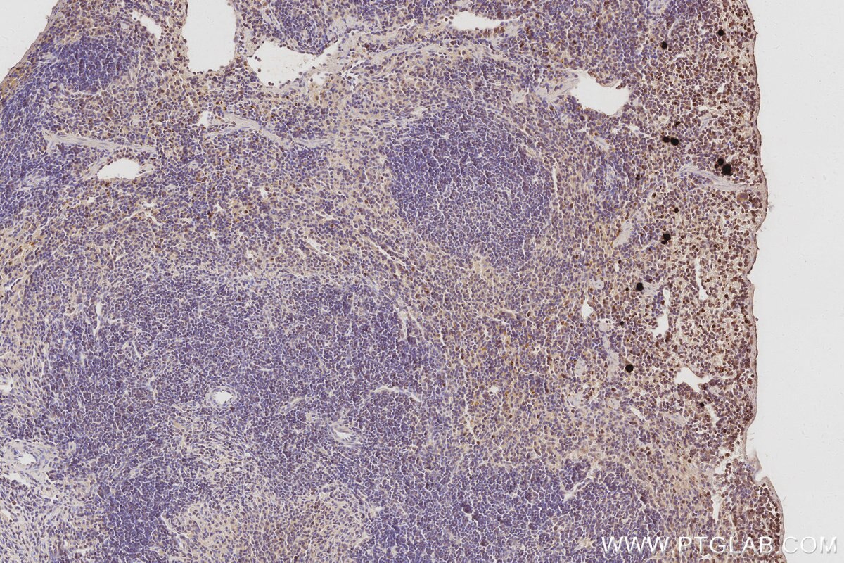 Immunohistochemical analysis of paraffin-embedded mouse spleen tissue slide using KHC3073 (FAM65B IHC Kit). Immunohistochemical analysis of paraffin-embedded mouse spleen tissue slide using KHC3073 (FAM65B IHC Kit).