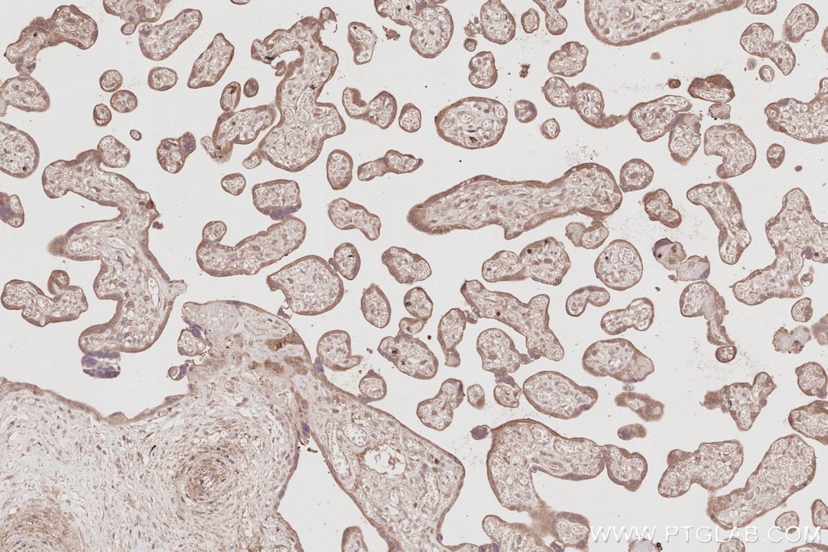 Immunohistochemical analysis of paraffin-embedded human placenta tissue slide using KHC3073 (FAM65B IHC Kit). Immunohistochemical analysis of paraffin-embedded human placenta tissue slide using KHC3073 (FAM65B IHC Kit).