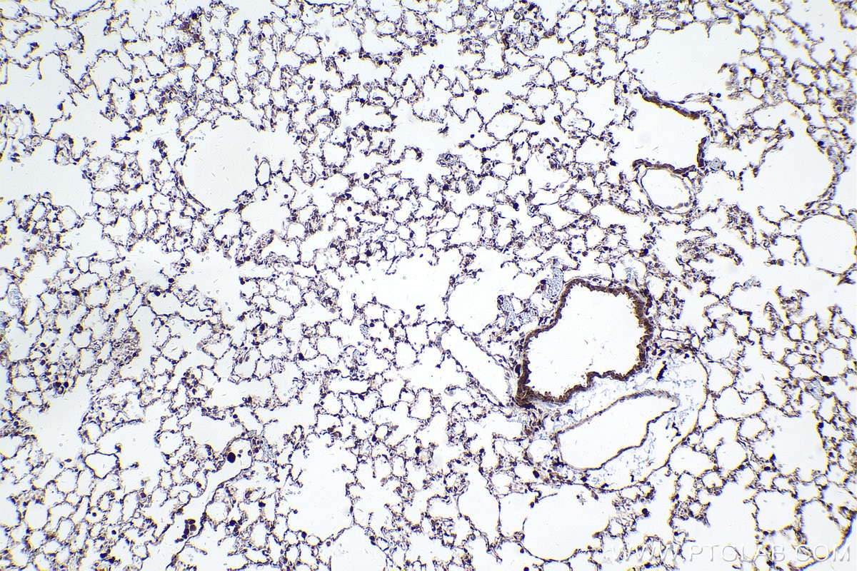 Immunohistochemical analysis of paraffin-embedded mouse lung tissue slide using KHC2409 (FAP IHC Kit).
