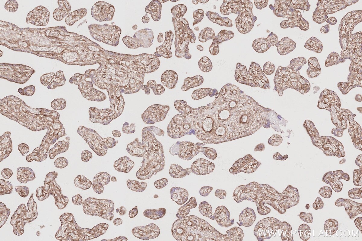 Immunohistochemical analysis of paraffin-embedded human placenta tissue slide using KHC3072 (FARP1 IHC Kit). Immunohistochemical analysis of paraffin-embedded human placenta tissue slide using KHC3072 (FARP1 IHC Kit).