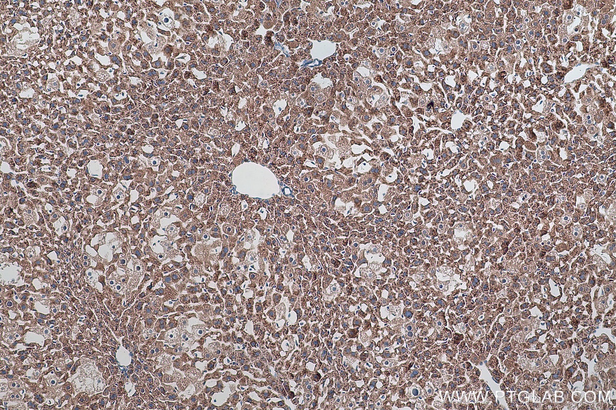 Immunohistochemical analysis of paraffin-embedded mouse liver tissue slide using KHC0886 (FARSA IHC Kit).