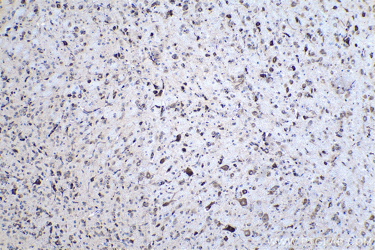 Immunohistochemical analysis of paraffin-embedded rat brain tissue slide using KHC0416 (FARSB IHC Kit).
