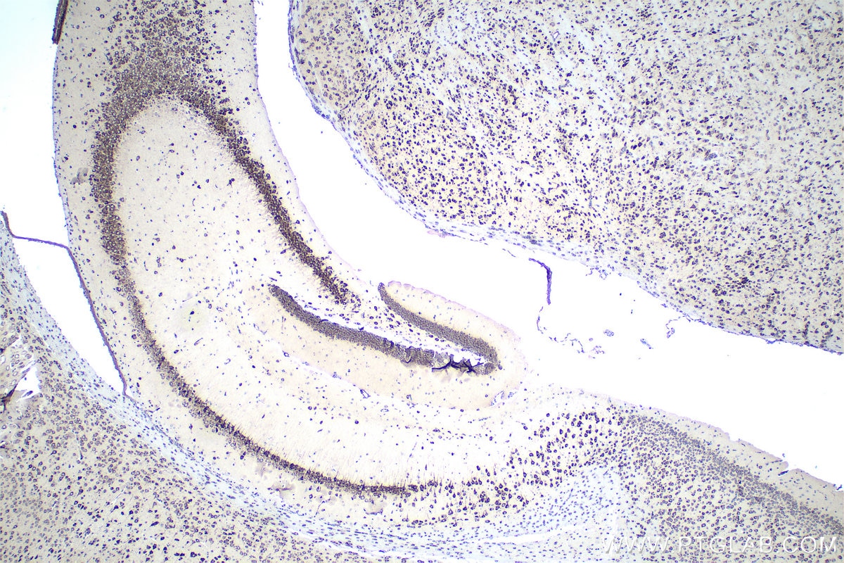 Immunohistochemical analysis of paraffin-embedded mouse brain tissue slide using KHC0416 (FARSB IHC Kit).