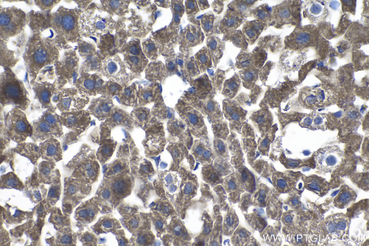 Immunohistochemical analysis of paraffin-embedded mouse liver tissue slide using KHC1103 (FASN IHC Kit).