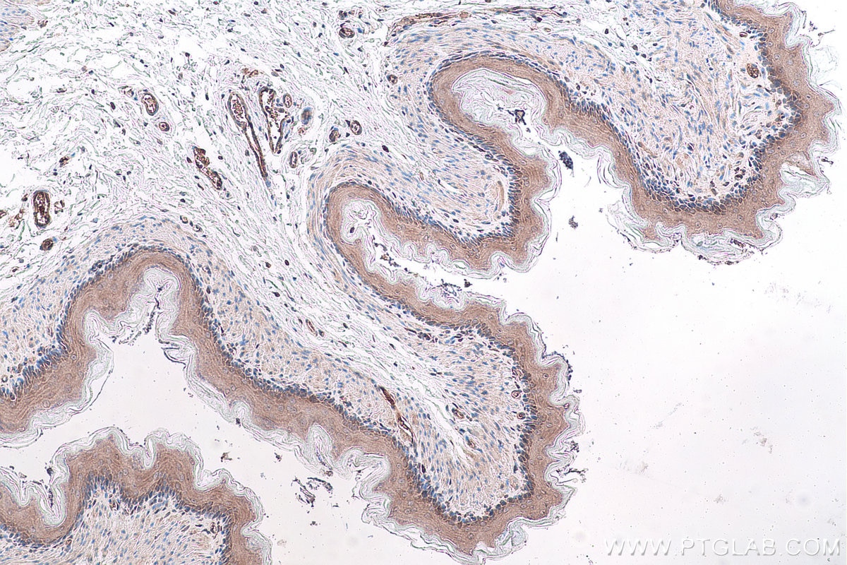 Immunohistochemical analysis of paraffin-embedded rat oesophagus tissue slide using KHC1008 (FAU IHC Kit).