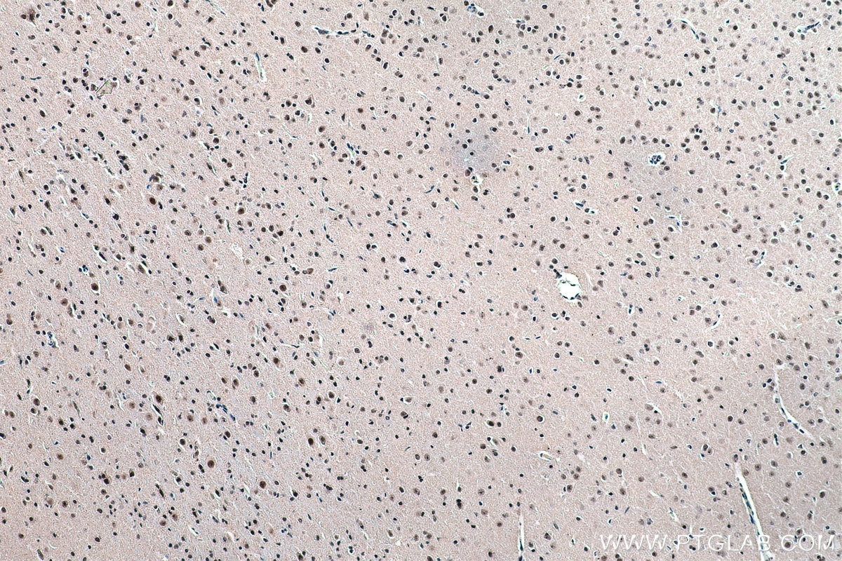 Immunohistochemical analysis of paraffin-embedded rat brain tissue slide using KHC0182 (FBL IHC Kit).