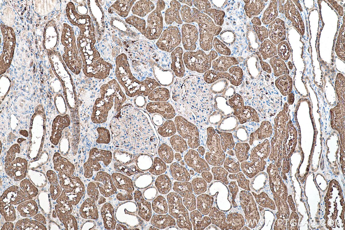 Immunohistochemical analysis of paraffin-embedded human kidney tissue slide using KHC0526 (FBP1 IHC Kit).