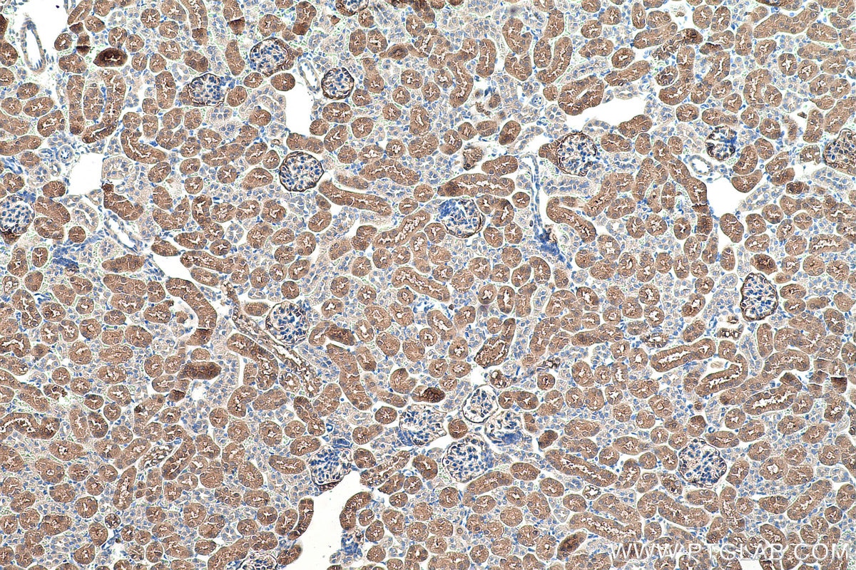 Immunohistochemical analysis of paraffin-embedded mouse kidney tissue slide using KHC0526 (FBP1 IHC Kit).