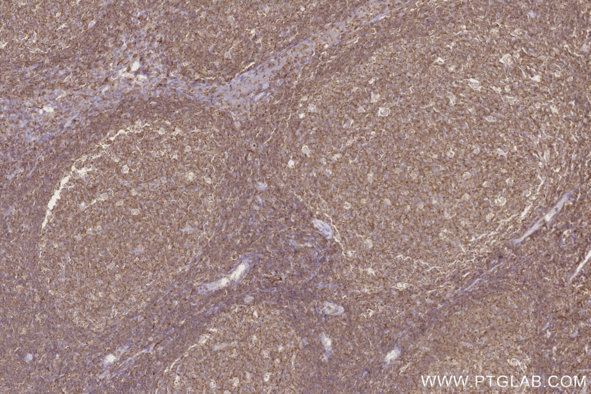 Immunohistochemical analysis of paraffin-embedded human tonsillitis tissue slide using KHC2830 (FBP17 IHC Kit).