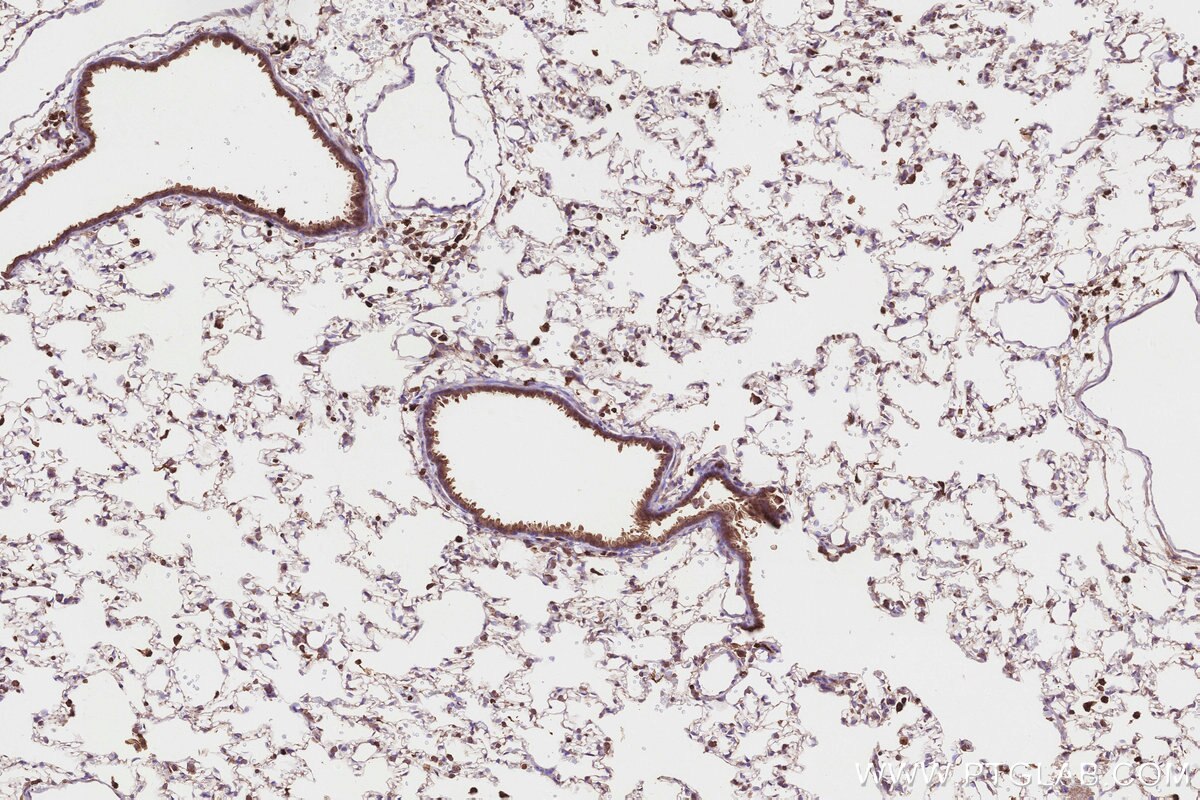Immunohistochemical analysis of paraffin-embedded rat lung tissue slide using KHC2830 (FBP17 IHC Kit).