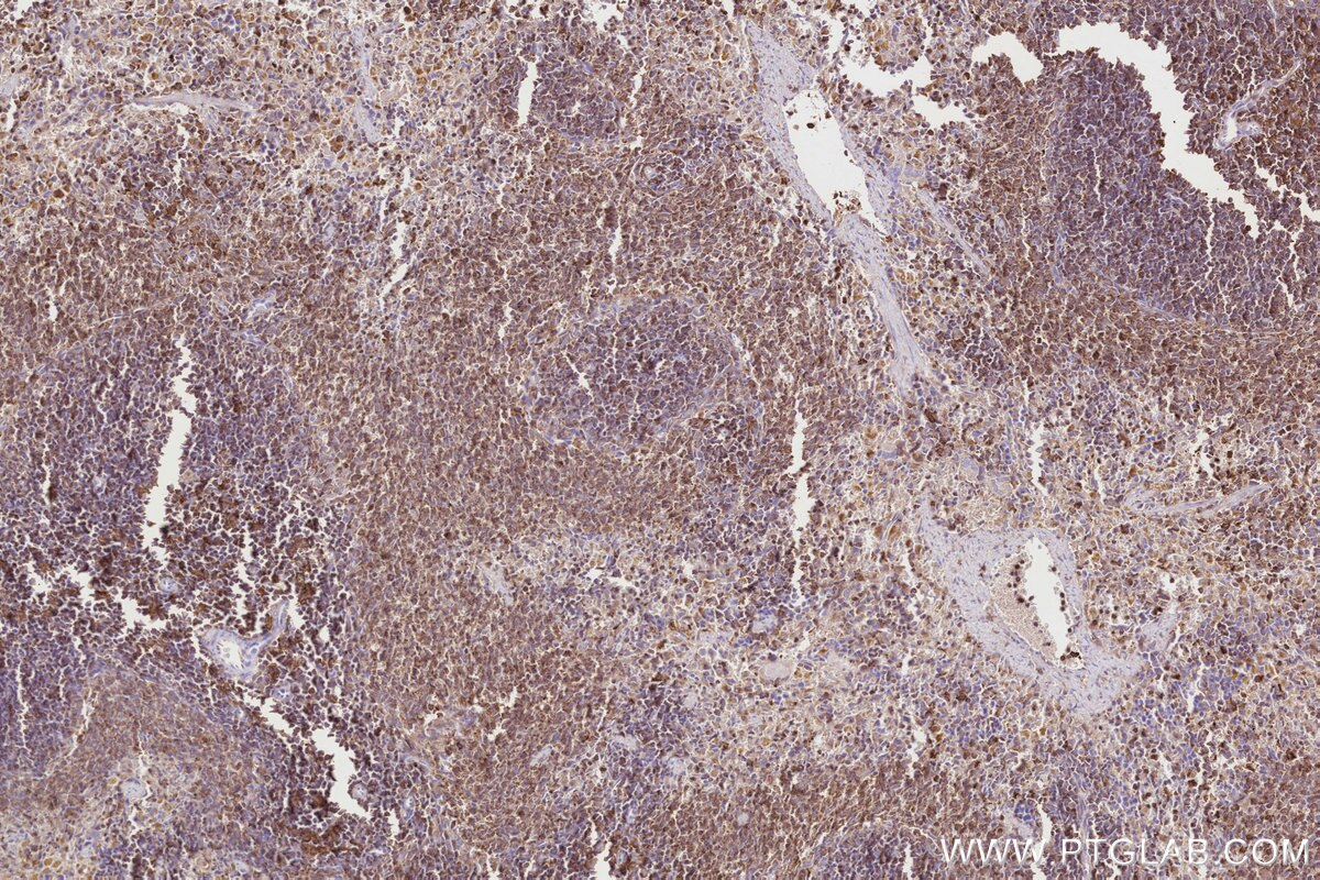 Immunohistochemical analysis of paraffin-embedded rat spleen tissue slide using KHC2830 (FBP17 IHC Kit).