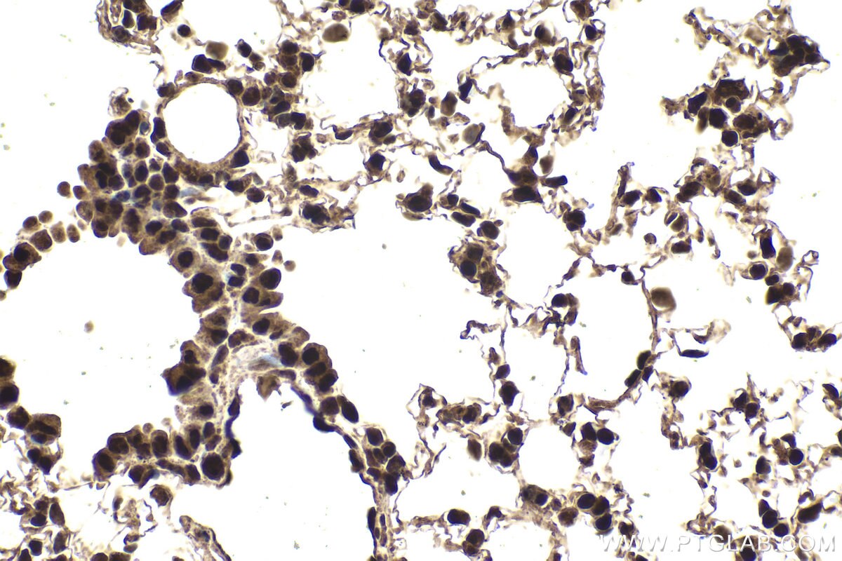 Immunohistochemical analysis of paraffin-embedded mouse lung tissue slide using KHC1994 (FBXO5 IHC Kit).
