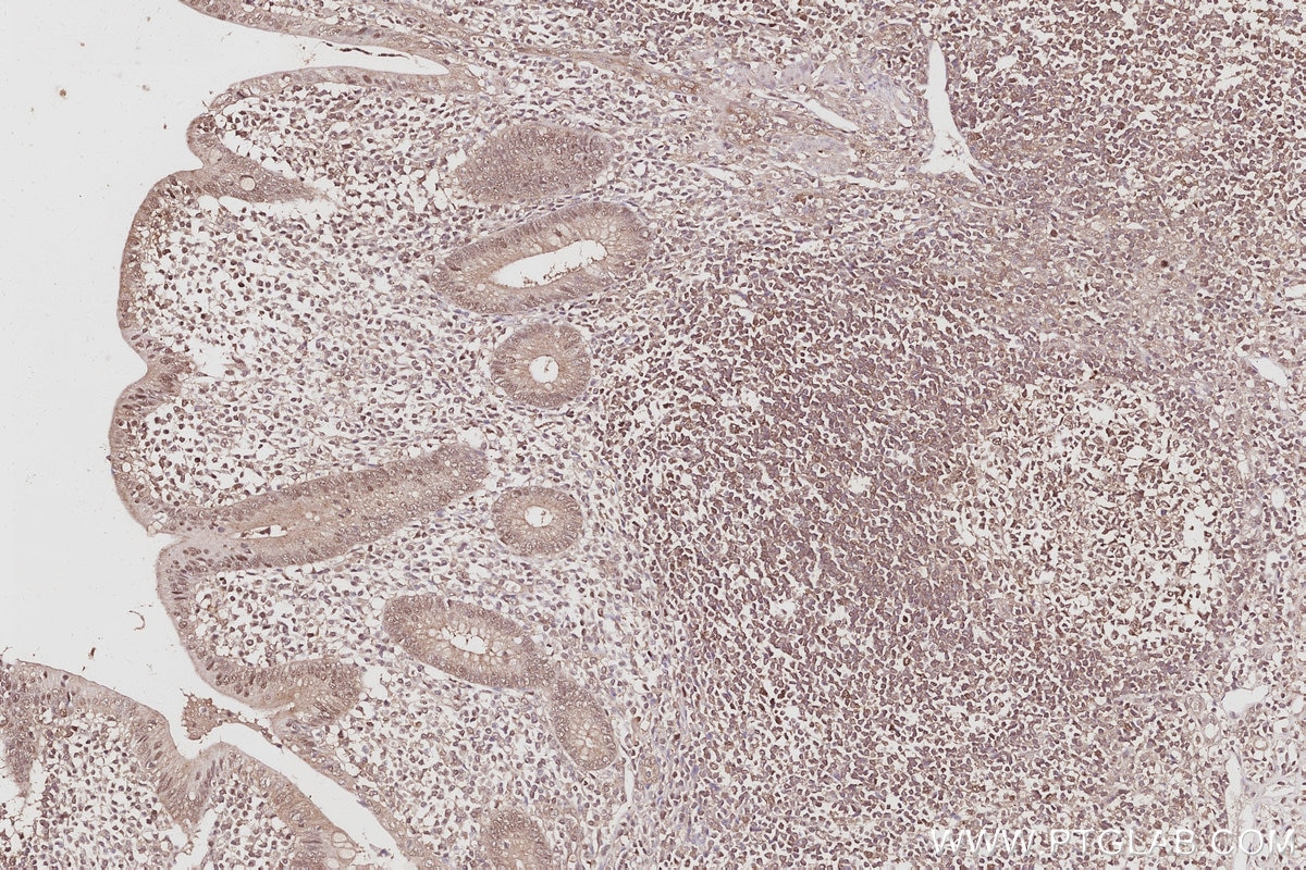 Immunohistochemical analysis of paraffin-embedded human appendicitis tissue slide using KHC3063 (FBXO7 IHC Kit).