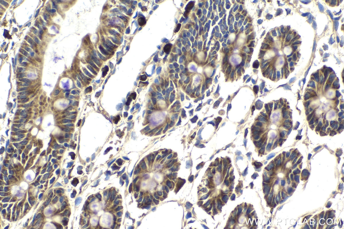Immunohistochemical analysis of paraffin-embedded rat small intestine tissue slide using KHC1989 (FBXW11 IHC Kit).