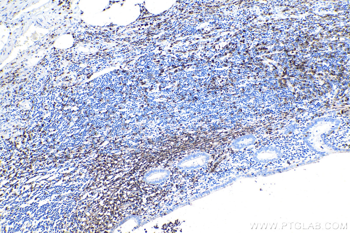 Immunohistochemical analysis of paraffin-embedded human appendicitis tissue slide using KHC1130 (FCN1 IHC Kit).