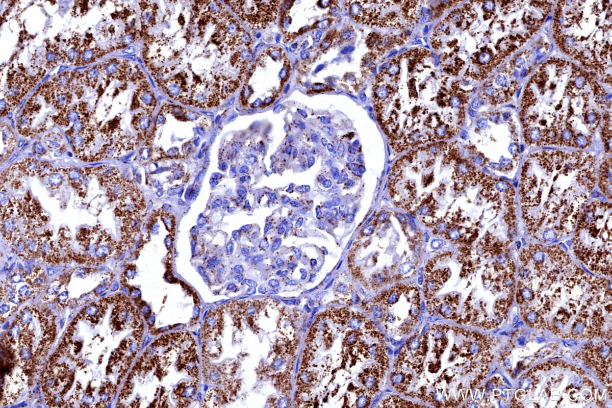 Immunohistochemical analysis of paraffin-embedded human kidney tissue slide using KHC3175 (FDX1 IHC Kit).