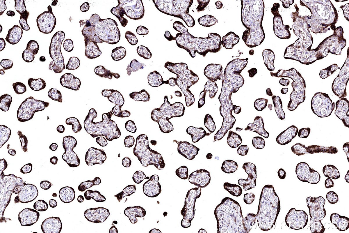 Immunohistochemical analysis of paraffin-embedded human placenta tissue slide using KHC3175 (FDX1 IHC Kit).