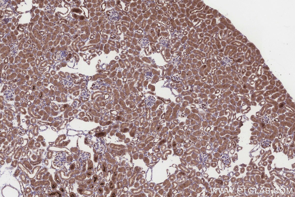 Immunohistochemical analysis of paraffin-embedded mouse kidney tissue slide using KHC3271 (FDX1L IHC Kit).