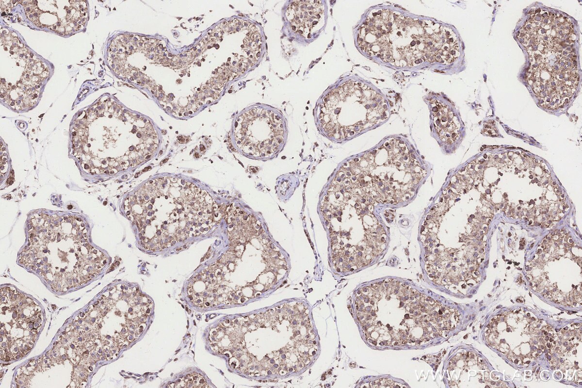 Immunohistochemical analysis of paraffin-embedded human testis tissue slide using KHC3271 (FDX1L IHC Kit).